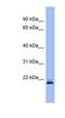 Ras Homolog, MTORC1 Binding antibody, NBP1-58861, Novus Biologicals, Western Blot image 