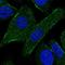 Transforming Growth Factor Beta Receptor 1 antibody, HPA056473, Atlas Antibodies, Immunofluorescence image 