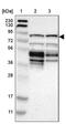 Cytoskeleton Associated Protein 2 antibody, PA5-52556, Invitrogen Antibodies, Western Blot image 