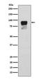 Glycogen Synthase 1 antibody, P03512-2, Boster Biological Technology, Western Blot image 