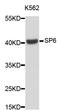 Sp6 Transcription Factor antibody, STJ26364, St John
