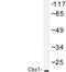 CDC28 Protein Kinase Regulatory Subunit 1B antibody, LS-C176919, Lifespan Biosciences, Western Blot image 