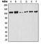 Nuclear Factor Kappa B Subunit 1 antibody, MBS821168, MyBioSource, Western Blot image 
