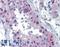 Rhox Homeobox Family Member 2 antibody, LS-B3518, Lifespan Biosciences, Immunohistochemistry paraffin image 