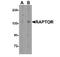 Regulatory Associated Protein Of MTOR Complex 1 antibody, NBP1-77211, Novus Biologicals, Western Blot image 