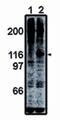 Protein Tyrosine Kinase 2 antibody, AMO0672, Invitrogen Antibodies, Western Blot image 