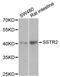 Somatostatin Receptor 2 antibody, STJ25706, St John