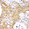 Actin Alpha 2, Smooth Muscle antibody, LS-C746774, Lifespan Biosciences, Immunohistochemistry paraffin image 