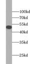 Zinc Finger Protein 2 antibody, FNab09666, FineTest, Western Blot image 