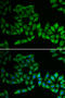 Thiopurine S-Methyltransferase antibody, 15-354, ProSci, Immunofluorescence image 