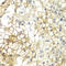 Syndecan 1 antibody, STJ25457, St John