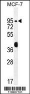 Rac GTPase-activating protein 1 antibody, 55-862, ProSci, Western Blot image 