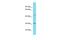 Coiled-Coil Domain Containing 103 antibody, A11814, Boster Biological Technology, Western Blot image 