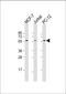 AKT Serine/Threonine Kinase 2 antibody, LS-C392658, Lifespan Biosciences, Western Blot image 