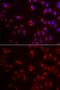 Preferentially Expressed Antigen In Melanoma antibody, GTX64679, GeneTex, Immunocytochemistry image 