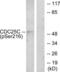 Cell Division Cycle 25C antibody, LS-C117316, Lifespan Biosciences, Western Blot image 