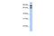 Cilia And Flagella Associated Protein 157 antibody, GTX45427, GeneTex, Western Blot image 