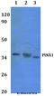 PIN2 (TERF1) Interacting Telomerase Inhibitor 1 antibody, A03576, Boster Biological Technology, Western Blot image 