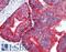Keratin 5 antibody, LS-B3891, Lifespan Biosciences, Immunohistochemistry paraffin image 