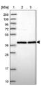 WD Repeat Domain 93 antibody, NBP2-32041, Novus Biologicals, Western Blot image 