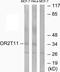 Olfactory Receptor Family 2 Subfamily T Member 11 (Gene/Pseudogene) antibody, GTX87237, GeneTex, Western Blot image 