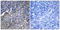 Collagen Type XIX Alpha 1 Chain antibody, LS-C119473, Lifespan Biosciences, Immunohistochemistry frozen image 