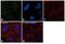 Integrin Subunit Beta 5 antibody, PA5-17260, Invitrogen Antibodies, Immunofluorescence image 