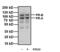 Progesterone Receptor antibody, MA5-12658, Invitrogen Antibodies, Western Blot image 