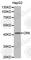 CRK Proto-Oncogene, Adaptor Protein antibody, A0868, ABclonal Technology, Western Blot image 