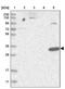 HAD antibody, PA5-57637, Invitrogen Antibodies, Western Blot image 