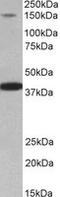 Insulin Receptor Substrate 4 antibody, MBS423134, MyBioSource, Western Blot image 