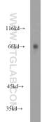 Myotubularin Related Protein 2 antibody, 14372-1-AP, Proteintech Group, Western Blot image 