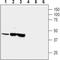 Corticotropin Releasing Hormone Receptor 1 antibody, PA5-77378, Invitrogen Antibodies, Western Blot image 