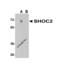 SHOC2 Leucine Rich Repeat Scaffold Protein antibody, 5215, ProSci, Western Blot image 