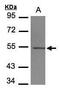Tubulin beta-4 chain antibody, PA5-21416, Invitrogen Antibodies, Western Blot image 