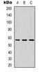 Dyskerin Pseudouridine Synthase 1 antibody, orb318768, Biorbyt, Western Blot image 