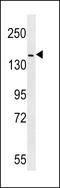 Erb-B2 Receptor Tyrosine Kinase 4 antibody, LS-C159823, Lifespan Biosciences, Western Blot image 