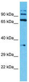 Transmembrane Serine Protease 7 antibody, TA330792, Origene, Western Blot image 