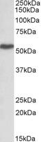 C-X-C Motif Chemokine Receptor 6 antibody, 42-573, ProSci, Enzyme Linked Immunosorbent Assay image 