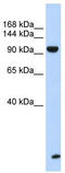 Trinucleotide Repeat Containing Adaptor 6B antibody, TA345747, Origene, Western Blot image 