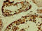 PHD Finger Protein 6 antibody, LS-C370110, Lifespan Biosciences, Immunohistochemistry paraffin image 