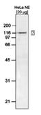 SWI/SNF Related, Matrix Associated, Actin Dependent Regulator Of Chromatin, Subfamily A, Member 5 antibody, NBP2-59191, Novus Biologicals, Western Blot image 