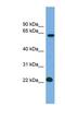 MIS18 Kinetochore Protein A antibody, NBP1-70753, Novus Biologicals, Western Blot image 