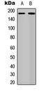 Erb-B2 Receptor Tyrosine Kinase 4 antibody, GTX32389, GeneTex, Western Blot image 