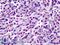 BRCA1 Associated Protein 1 antibody, LS-C141679, Lifespan Biosciences, Immunohistochemistry paraffin image 