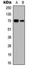 Ribosomal Protein S6 Kinase B1 antibody, LS-C368530, Lifespan Biosciences, Western Blot image 