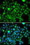 N-6 Adenine-Specific DNA Methyltransferase 1 antibody, 22-778, ProSci, Immunofluorescence image 