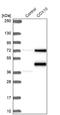 Cytochrome C Oxidase Assembly Factor Heme A:Farnesyltransferase COX10 antibody, NBP1-86322, Novus Biologicals, Western Blot image 