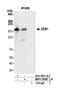 Zinc Finger E-Box Binding Homeobox 1 antibody, NBP1-05987, Novus Biologicals, Western Blot image 