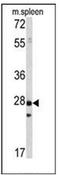 Protein Tyrosine Phosphatase 4A1 antibody, AP15254PU-N, Origene, Western Blot image 